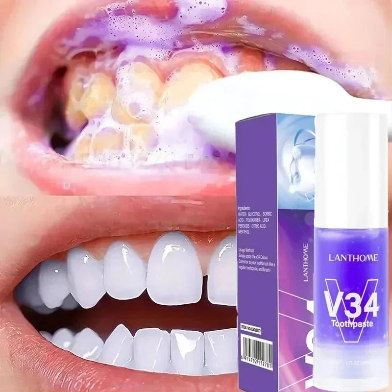 Clareador Dentário Smile Pro V34 💜