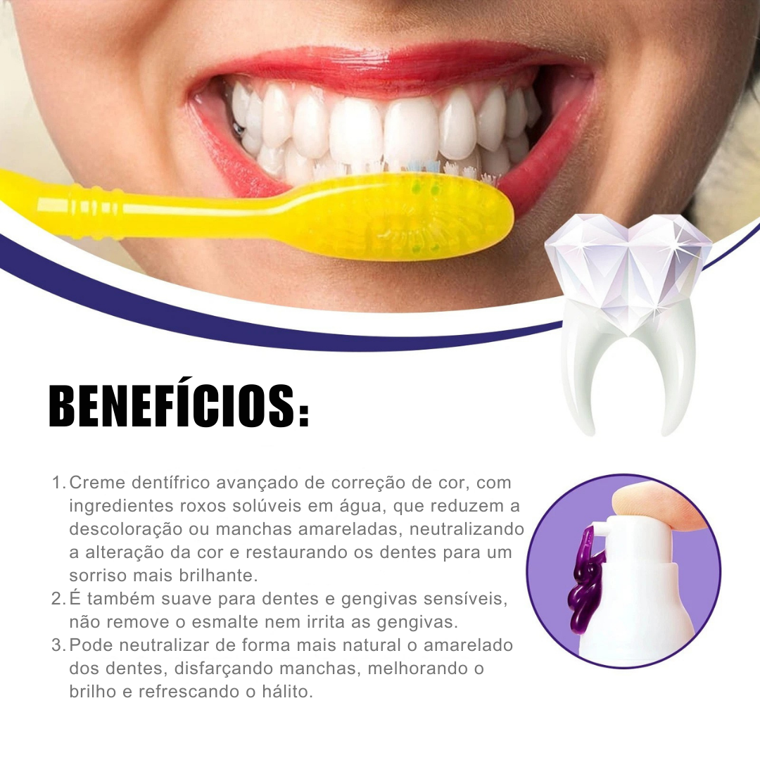 Clareador Dentário Smile Pro V34 💜
