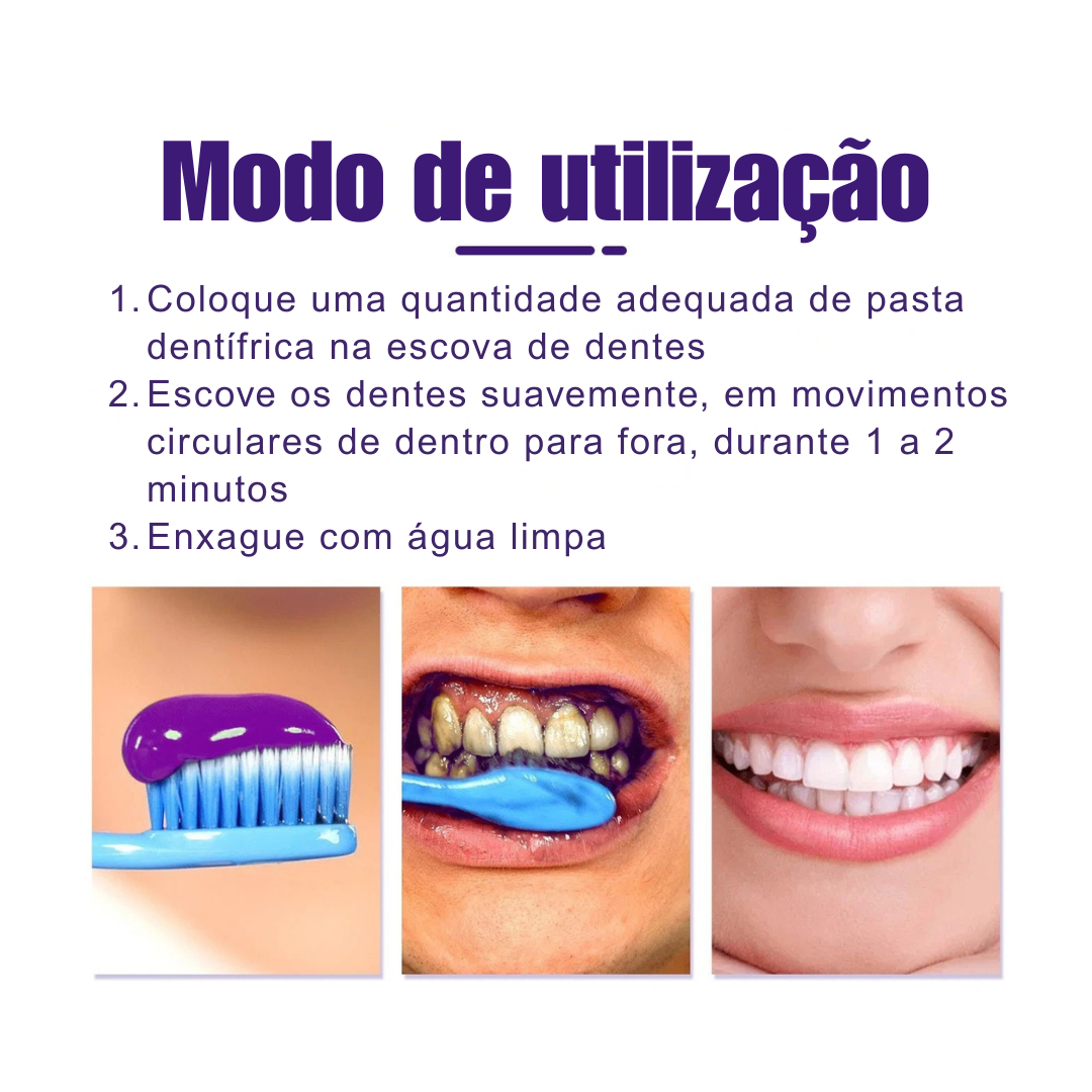 Clareador Dentário Smile Pro V34 💜
